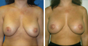 Before & After Photos